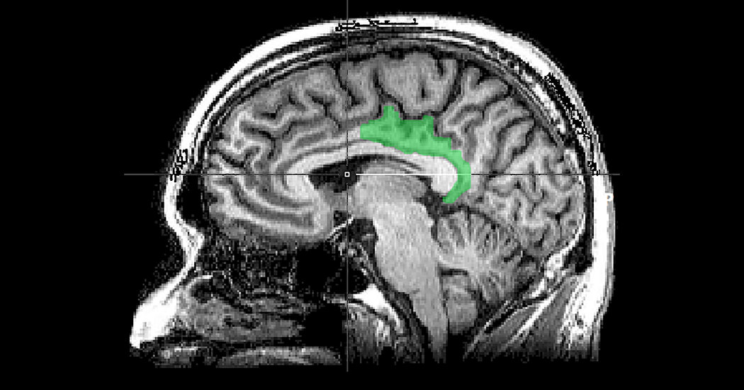 Brain study suggests that traumatic memories are processed as a present experience